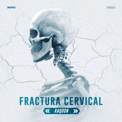 Fractura Cervical